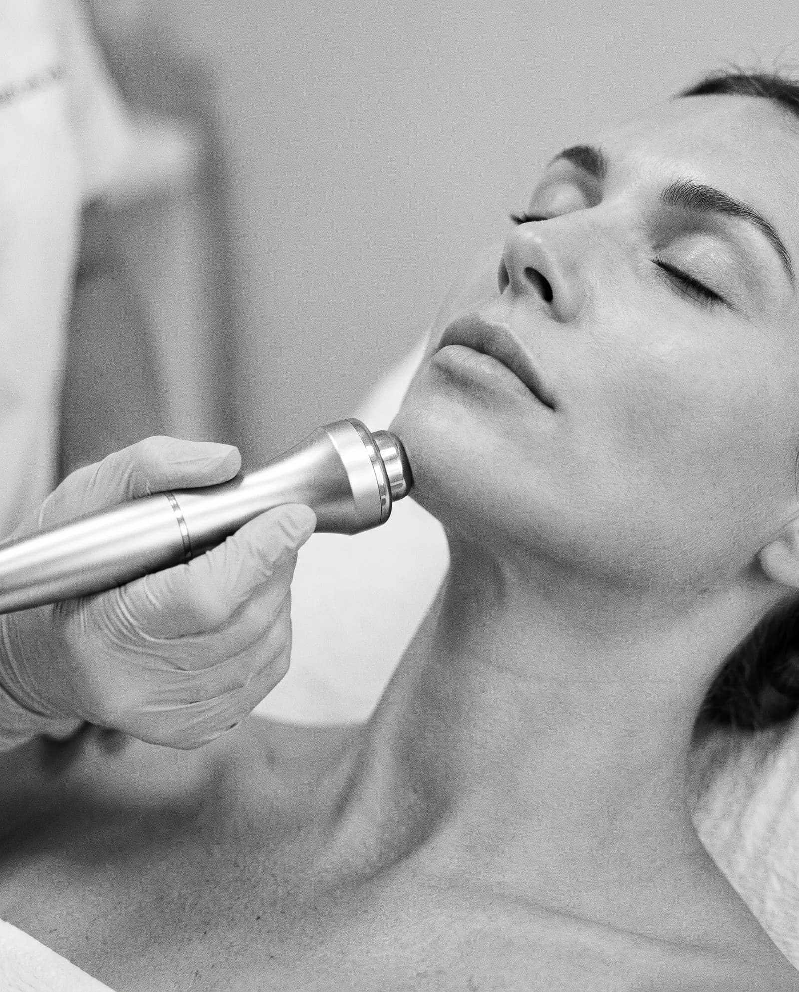 RF Rejuvenation & Scar Treatment